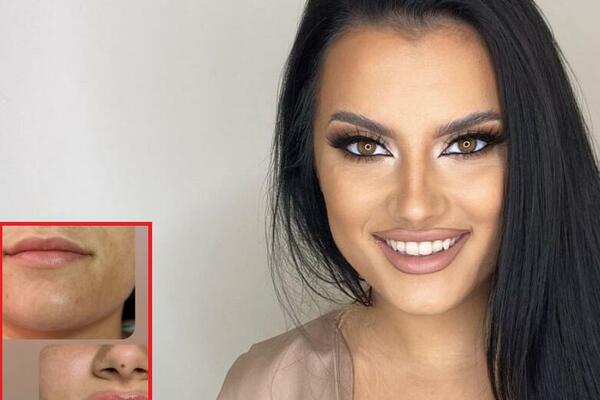 PAO REMONT KOD PLASTIČARA: Naša pevačica pokazala PROMENU na LICU, svi bulje u jedan DETALJ!