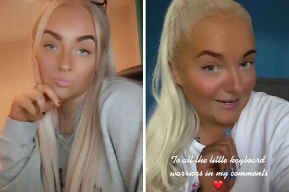 DOBILA JE MENSTRUACIJU SA 18 MESECI, A GRUDI IMA OD SEDME GODINE: Ljudi u šoku kad je vide, niko ne veruje!