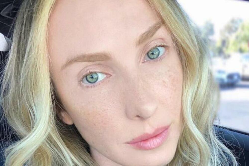 PEVAČICA OTKRILA ŠOKANTNU ISTINU O SVOM ZDRAVLJU: Pokazala je BELEG na telu koji KRIJE TAJNU (VIDEO)