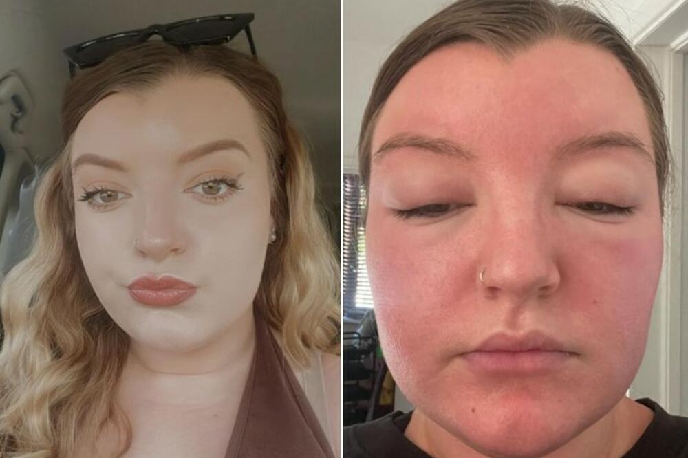 NIJE OBRAĆALA PAŽNJU NA SIMPTOME I LEGLA JE DA SPAVA: Ujutru nije mogla ništa, a mi ovu grešku pravimo STALNO