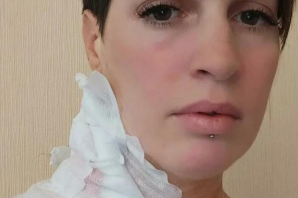 KATARINA GODINAMA IŠLA U SOLARIJUM, PA JOJ IZVADILI ORGANE DA BI PREŽIVELA: Valjevka uputila SNAŽNE REČI svima