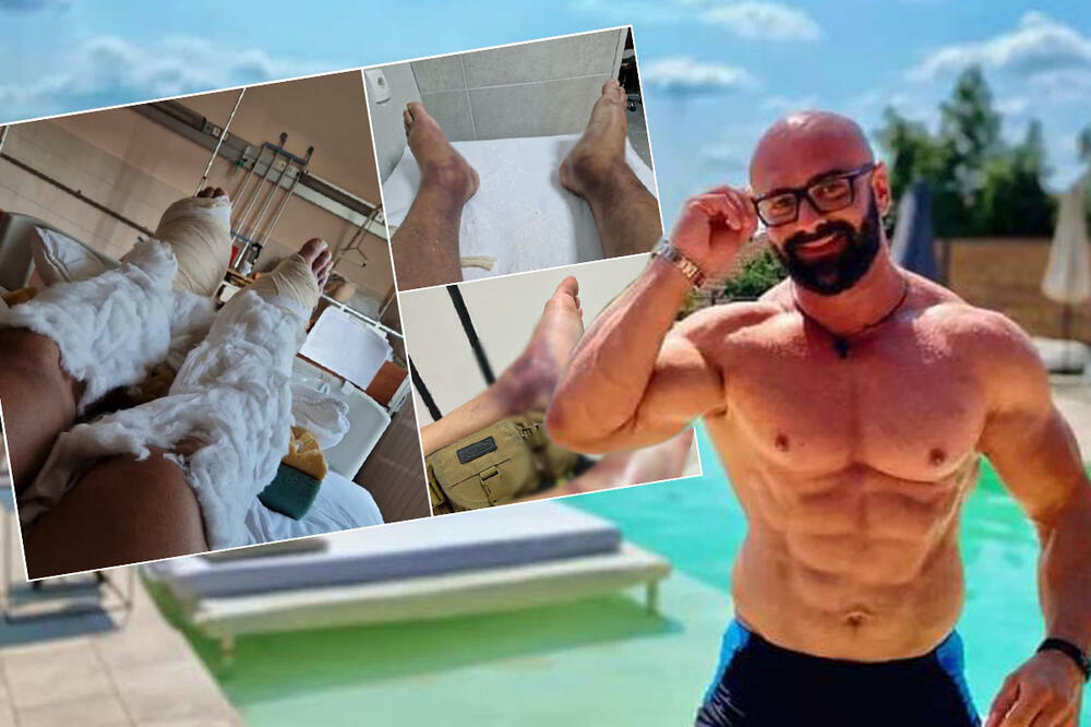 LEPOMIR BAKIĆ DOŽIVEO OZBILJNU NESREĆU!