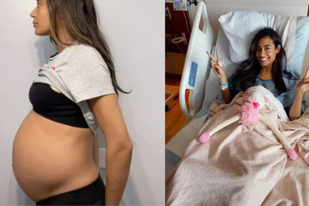 UMESTO BEBE, IZ NJE JE IZAŠLO OVO: Kosa mi je opadala, mnogo je bolelo (VIDEO)