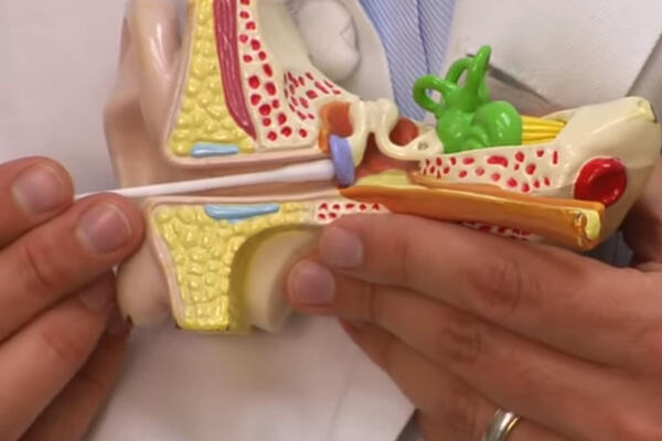 TRIK ZA ČIŠĆENJE UŠIJU ZALUDEO SRBE! Čitav život ste to radili POGREŠNO, doktor sve otkrio (VIDEO)