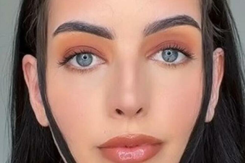 ZA 60 SEKUNDI I 0 DINARA ZBRISALA 5 GODINA SA LICA: Kada vidite kako, ONESVESTIĆETE SE (VIDEO)