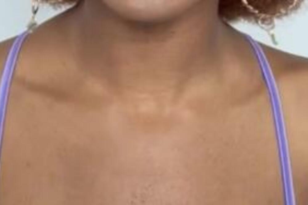 DEVOJKA JAVNO POKAZALA ŠTA JOJ VIRI IZ DEKOLTEA, PA ZGROZILA SVET: Svi gledaju u GRUDI i čude se kako IZDRŽAVA