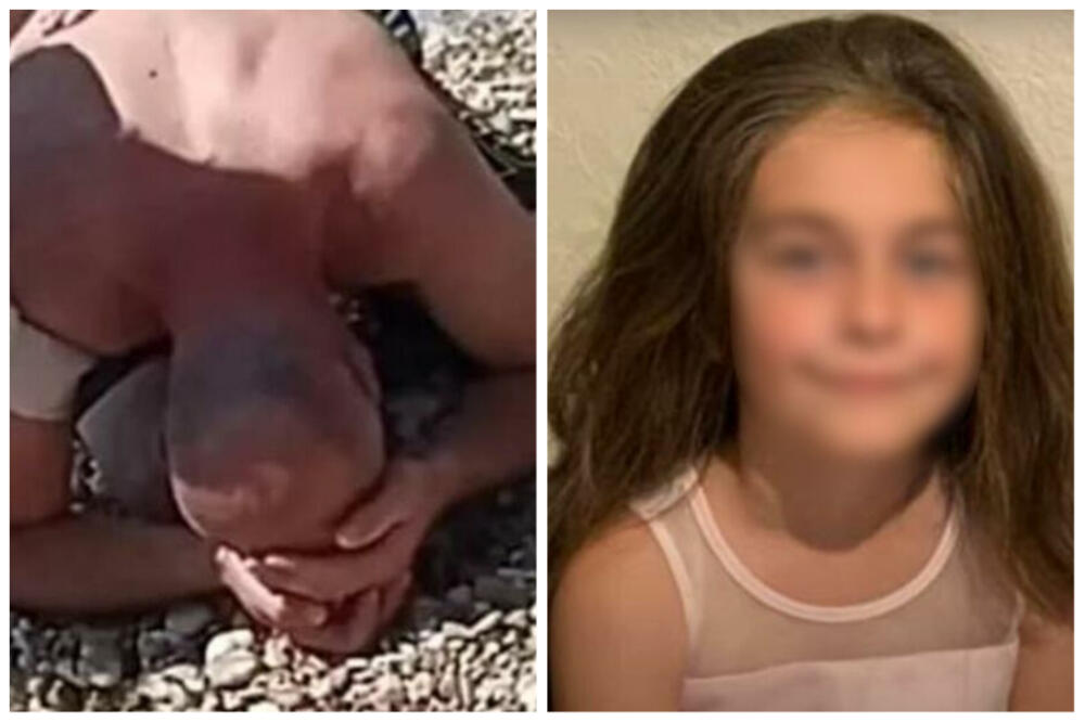 UHAPŠEN POLICAJAC KOJI JE GLISEROM USMRTIO DEVOJČICU (7): Još 15 njih DOBILO OTKAZE, stravična TRAGEDIJA