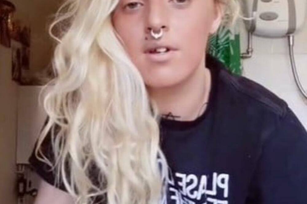 DEVOJKA POKAZALA ŠTA JOJ JE IZAŠLO NA ČELU I ZAPREPASTILA SVE: Ljudi ne veruju DA JE TOLIKO (VIDEO)