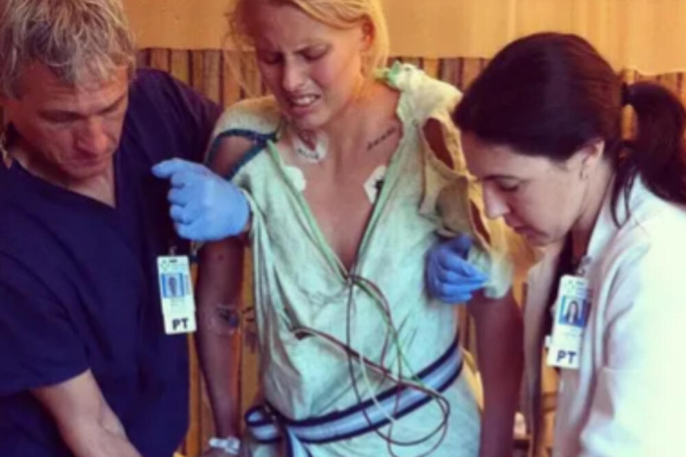 STAVLJALA JE TO IZMEĐU NOGU, I IZGUBILA OBE! Pretrnućete kada vidite JEZIVE FOTOGRAFIJE (FOTO)