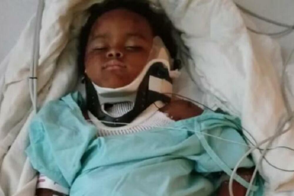 BESNI PITBUL NAPAO DEČAKA (4)! Bilo je NAPETO, ali NJENA brza REAKCIJA mu je spasila ŽIVOT