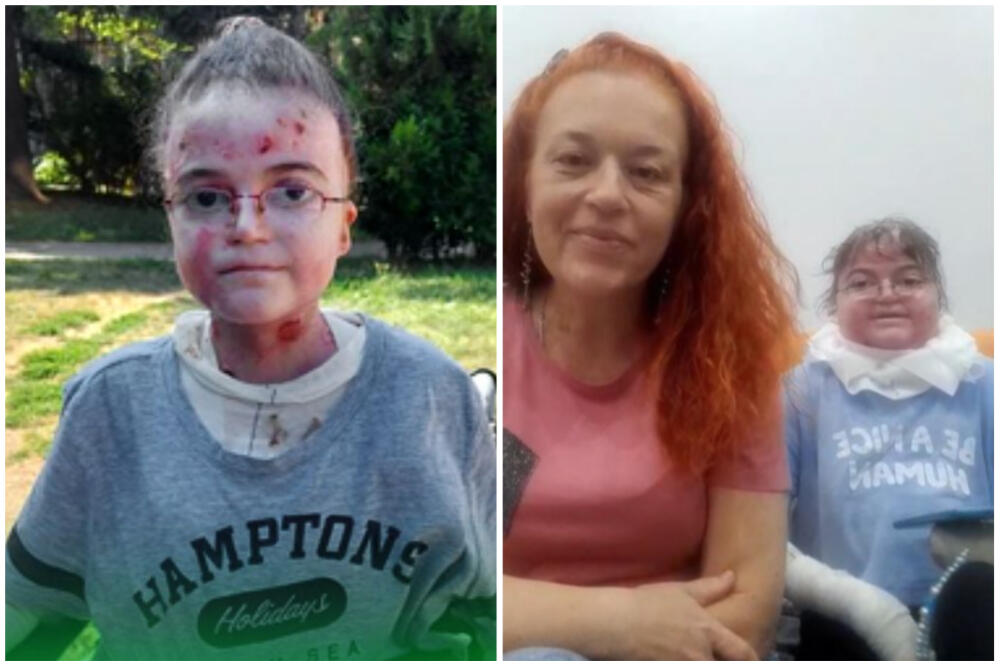 ANA (20) JE DETE LEPTIR, BOLI JE SVAKI DODIR, U SVAKOM MOMENTU: Sa majkom licitira stvari da bi se LEČILA! (FOTO)