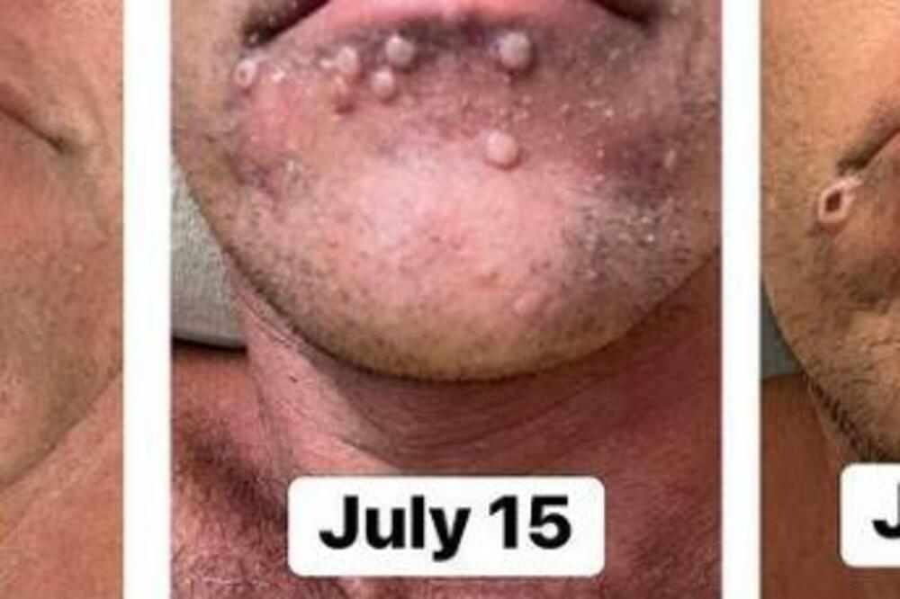 MUŠKARAC POKAZAO PROGRES MAJMUNSKIH BOGINJA ZA SAMO 20 DANA: Ulazite na sopstvenu odgovornost (FOTO)