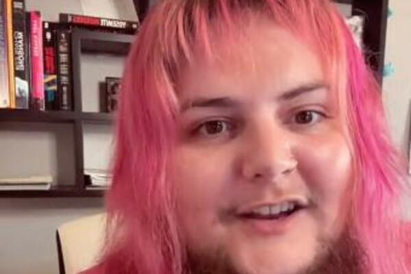 BRADA JE POČELA DA JOJ RASTE U PUBERTETU PA JE RADILA U CIRKUSU: Sada se više ne brije i oseća se nikad PRIVLAČNIJE