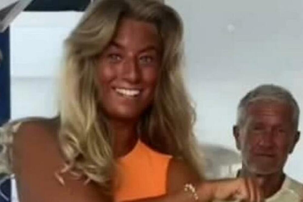 PO CELOM JOJ JE TELU! Ima 24, a zbog OVOG svi je smatraju za 40-godišnjakinju (FOTO)