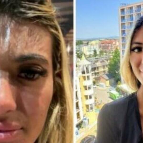 DEVOJKA JE NA SAMO 30 MINUTA ZASPALA NA BAZENU! Šokantno na šta joj je LIČILO kada se probudila (FOTO)