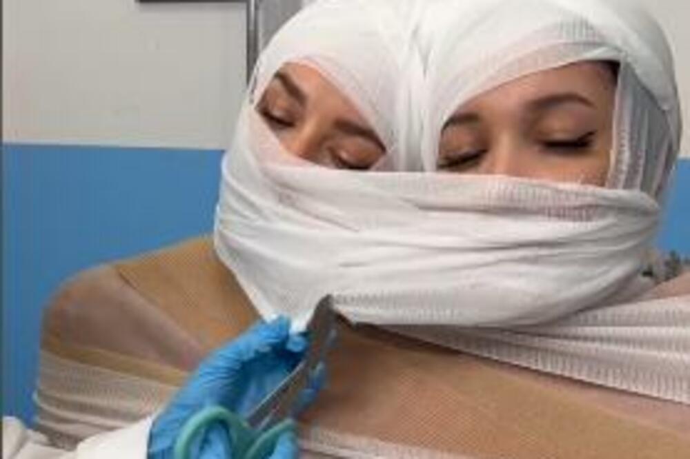 "SIJAMSKE BLIZANKINJE" SNIMILE PROCES RAZDVAJANJA, A ONDA OBRT: Razapeli ih na MREŽAMA, zapenili od BESA (VIDEO)
