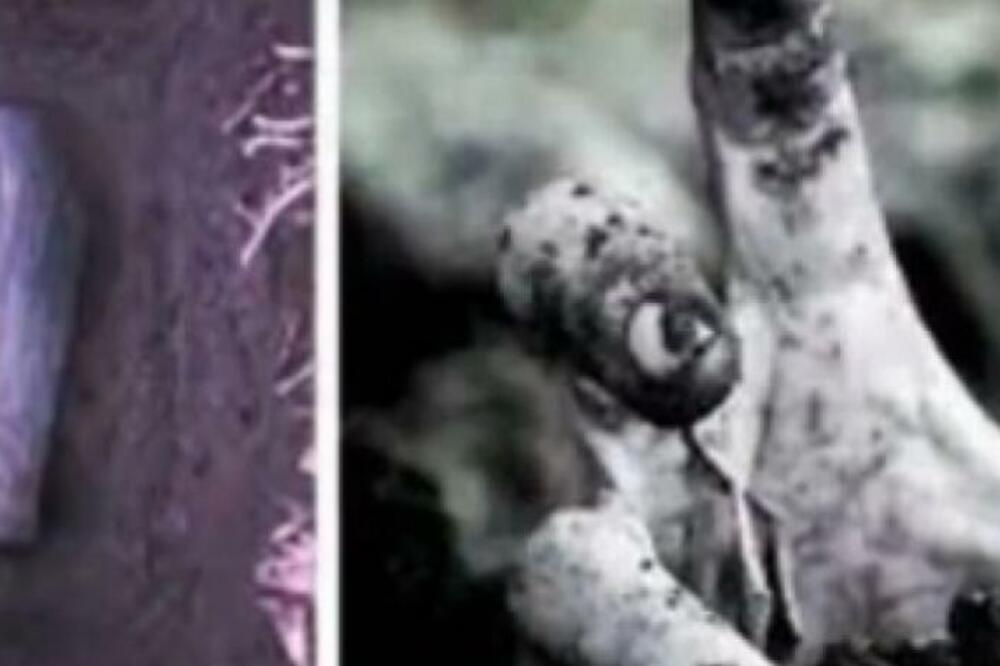 VIKTORA SU ŽIVOG SAHRANILI, SAMO JE BIO PIJAN: Jedva je izvukao živu glavu, a ono što se posle desilo je JEZIVO