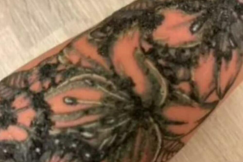 ISTETOVIRALA SE, A ONDA JE 24 SATA KASNIJE IZ NJE NEŠTO POČELO DA IZLAZI! Uopšte nije ličilo na ruku (VIDEO)