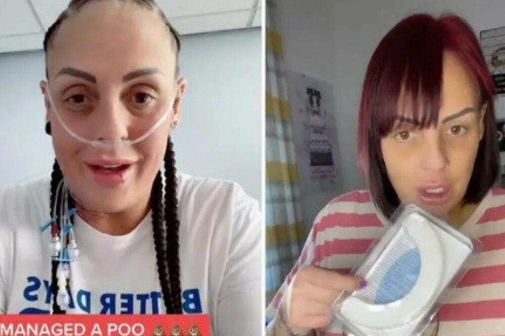 MESEC DANA NIJE OBAVILA VELIKU NUŽDU, PA POKAZALA KAKO IZGLEDA: Ceo svet ŠOKIRAN zbog JEZIVOG PRIZORA (FOTO)