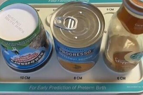 UZ POMOĆ NAMIRNICA POKAZALA KOLIKO SE ZAPRAVO OTVARA GRLIĆ MATERICE PRILIKOM POROĐAJA: Gledajte samo OVO! (VIDEO)