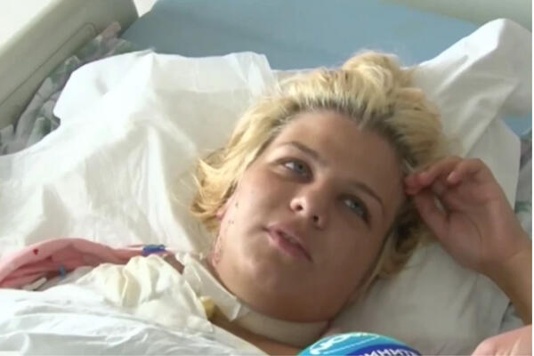 TEODORU (18) UDARIO GROM I OSTAVIO JOJ OŽILJAK U OBLIKU SRCA: Danima je bila u KOMI, njena priča će vas NAJEŽITI!