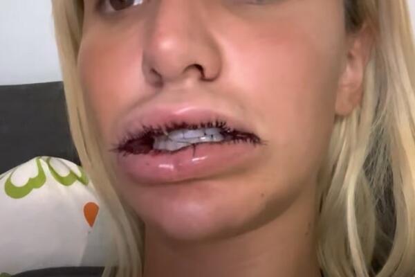 UNAKAŽENA ALEKSANDRA NIKOLIĆ: Objavila ŠOKANTNI VIDEO!