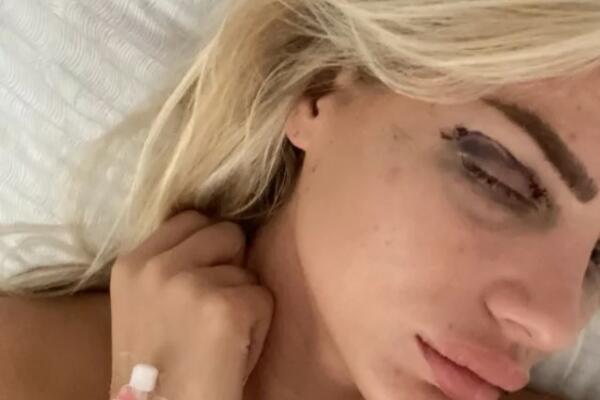 UPOZORENJE: POTRESNE FOTKE! Milica zavšrila u BOLNICI!