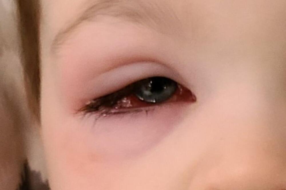 "SVA DECA IMAJU OVU IGRAČKU ZBOG KOJE JE MOJ SIN UMALO OSLEPEO": Očajna majka UPOZORILA na GOLEMU OPASNOST