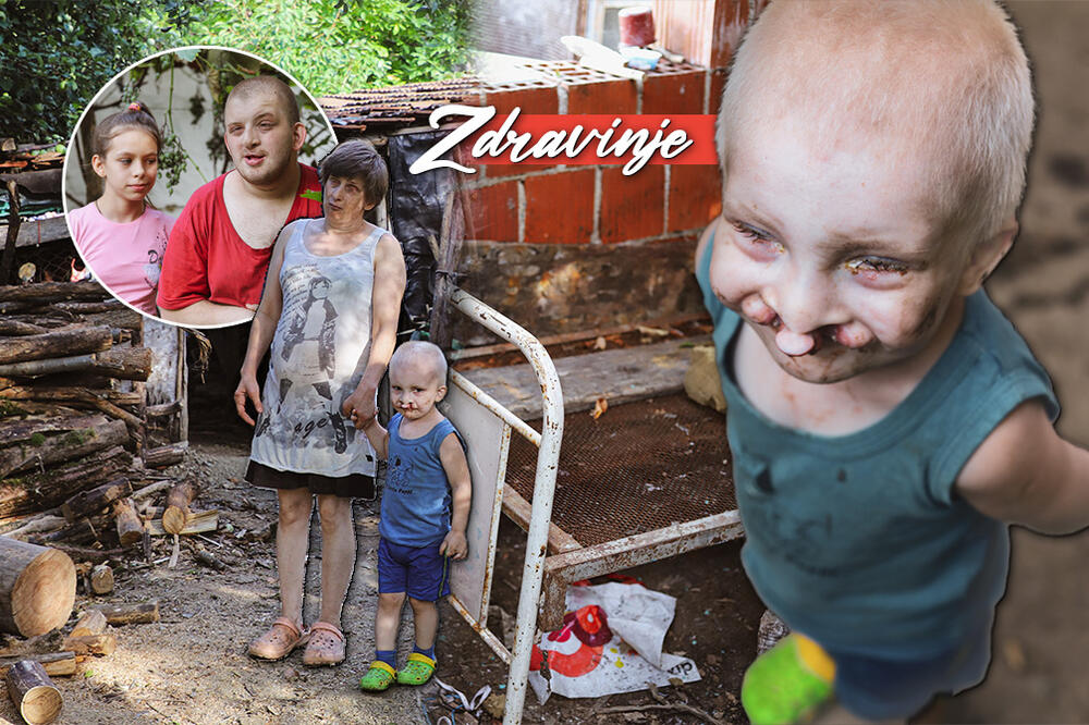 MALI PAVLE (3) ĆE IMATI NAJMANJE 10 OPERACIJA: Danas je primljen u "Tiršovu", NEĆE BITI LAKO! (FOTO)