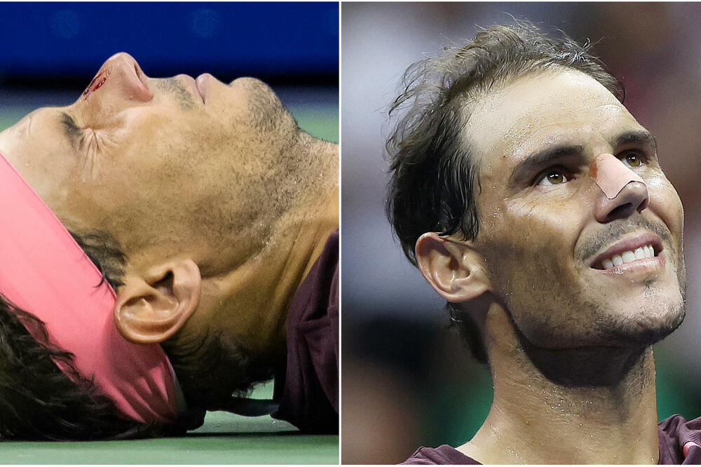 PAKLEN OKRŠAJ NADALA I FONJINIJA: Rafa bio GOTOV, 'digao se iz mrtvih', pa KRVAVOG NOSA završio posao! (VIDEO)