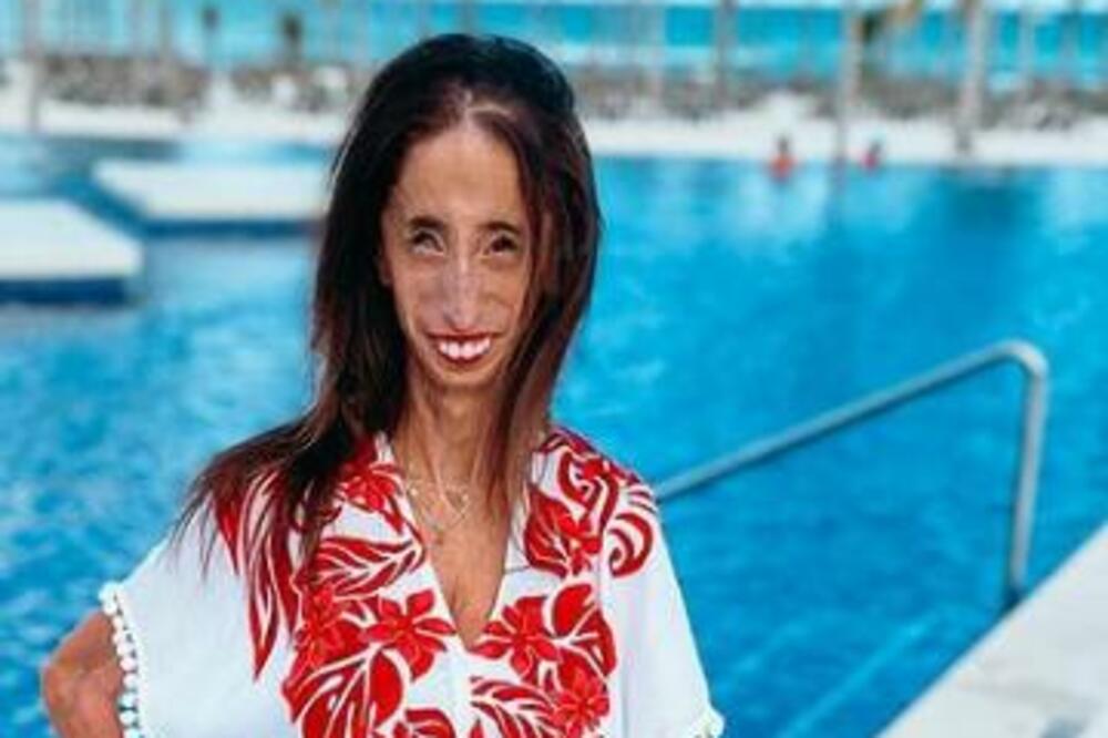 KAKO IZGLEDA KADA STE NAJRUŽNIJA OSOBA NA SVETU?! Ova ŽENA nosi tu TITULU, evo kako reaguje (FOTO)