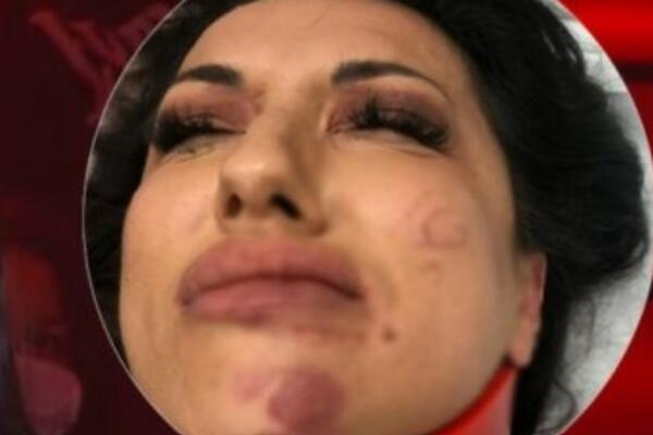 PRETUČENA ZVEZDA GRANDA TRPI JEZIVE BOLOVE: Krenula je kod PSIHIJATRA, nije dobro!