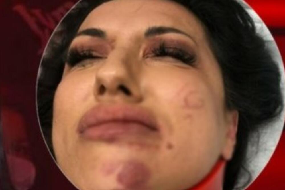 PRETUČENA ZVEZDA GRANDA TRPI JEZIVE BOLOVE: Krenula je kod PSIHIJATRA, nije dobro!