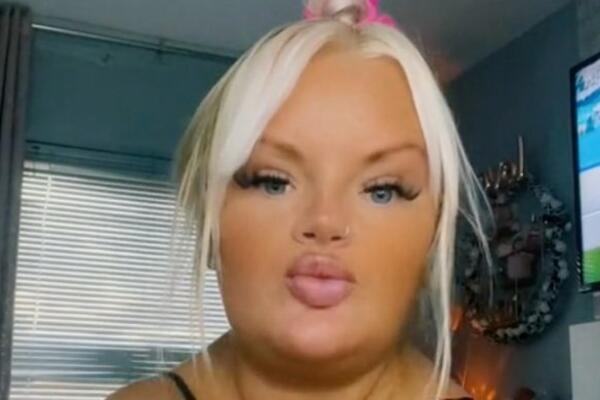 OVA ŽENA NEMA KLJUČNE KOSTI! Zbog genetske BOLESTI jedina je koja može OVO SA RUKAMA (VIDEO)