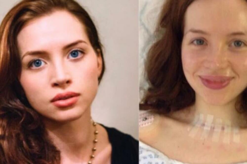 NA OVOJ FOTOGRAFIJI SE JASNO VIDI SIMPTOM RAKA! Devojka nije ni SLUTILA pakao (FOTO)