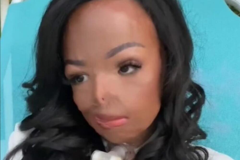 OTIŠLA JE U KUHINJU SA MOKROM KOSOM, A ONO ŠTO JOJ SE DESILO OBELEŽILO JE ZA ŽIVOTA: Samo je počela da GORI (VIDEO)