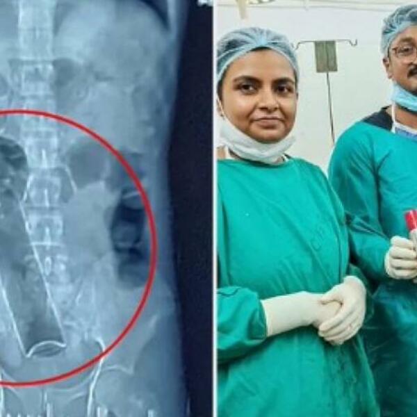 ZAGLAVILO MU SE U ANALNOM OTVORU: 20 dana nije imao NUŽDU, a onda su se LEKARI FRAPIRALI (VIDEO)