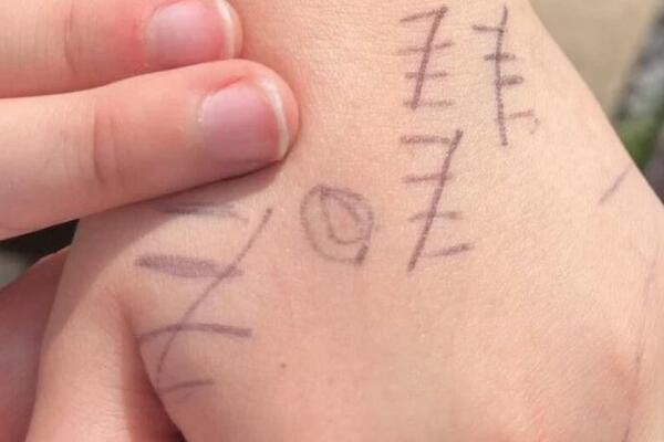 VIDEO SINU IŠARANE RUKE PA SMESTA POZVAO POLICIJU: Iza svega se krila UŽASAVAJUĆA ISTINA, ZALEDIĆETE SE (FOTO)