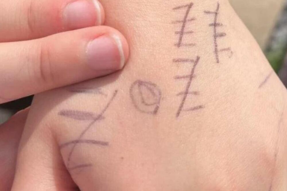 VIDEO SINU IŠARANE RUKE PA SMESTA POZVAO POLICIJU: Iza svega se krila UŽASAVAJUĆA ISTINA, ZALEDIĆETE SE (FOTO)