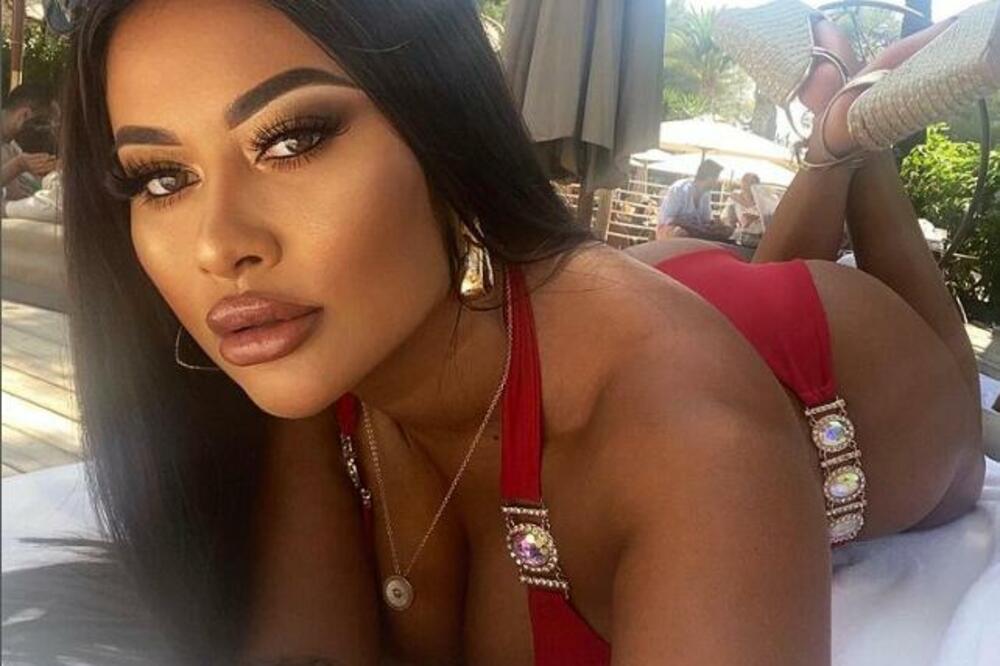 VIŠE NE MOŽE NI FARMERKE DA OBUČE: Horor ispovest POZNATE LEPOTICE - ŽIVOT JOJ JE POSTAO AGONIJA! (FOTO)