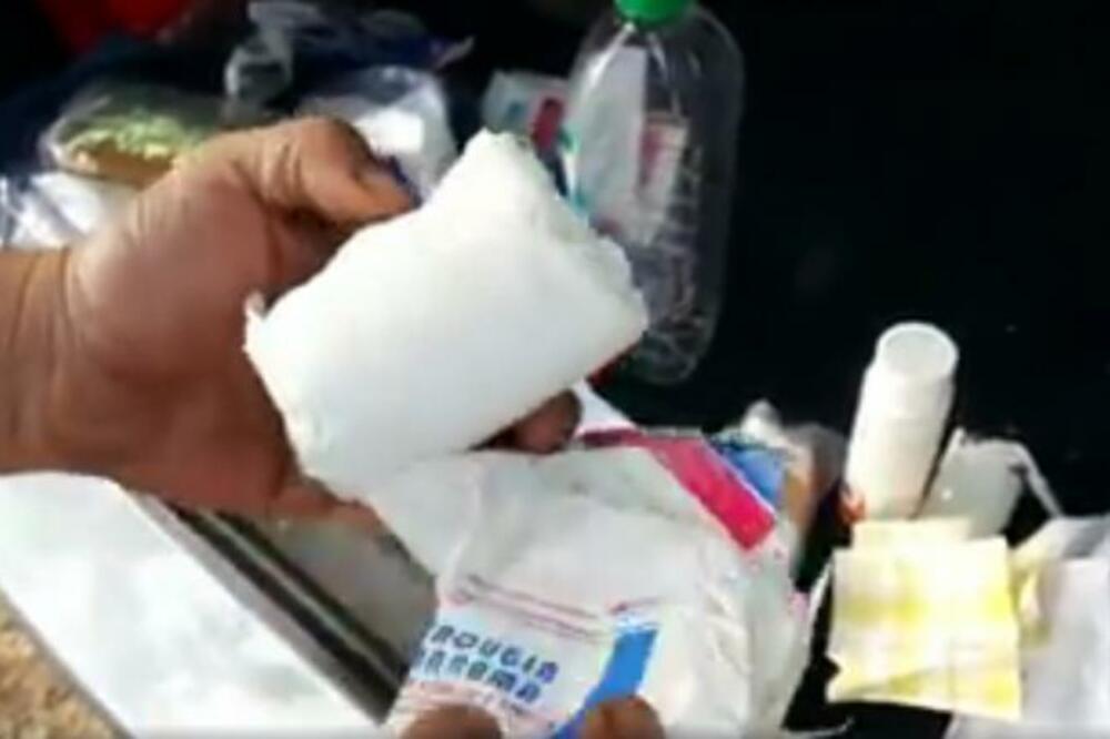 BEOGRAĐANKA JE OTVORILA PAKET ZA PRVU POMOĆ! Kada je videla šta je unutra, zanemela je, KAKO JE DO OVOGA DOŠLO?