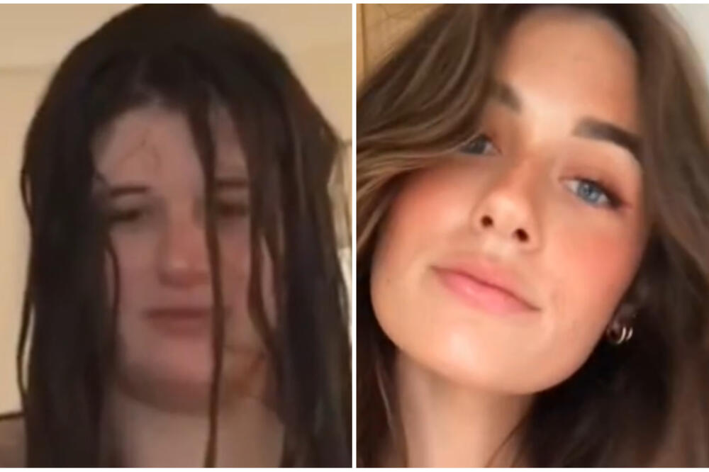 USPELA JE DA SMRŠA 76 KILOGRAMA, A SADA PROLAZI KROZ PAKAO: Otpalo joj je POLA KOSE, a ovo joj je NAJGORE od SVEGA