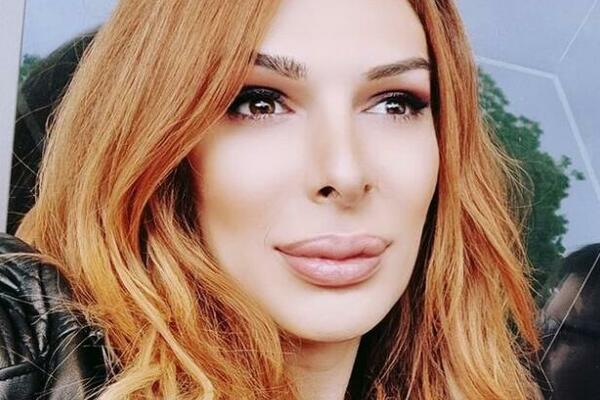 PREBIJENA SRPSKA TRANSRODNA PEVAČICA: Tvrdi da je BATINE dobila od DRUGA rijaliti zvezde i njegove ŽENE
