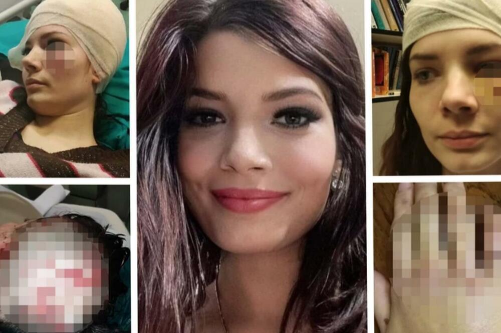 "DOŠAO JE DA VIDI DECU, PA ME SKORO UBIO TEGOVIMA!" Mihaela podelila potresnu ispovest, NASILNIK IZLAZI NA SLOBODU!