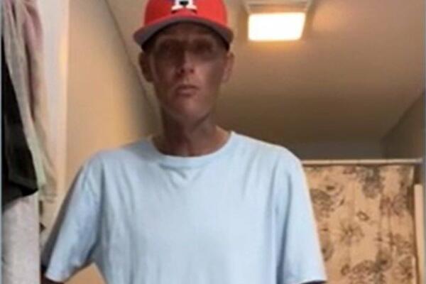 UZIMAO POPULARAN LEK, PA OSTAO ZGRANUT ODRAZOM U OGLEDALU: I lekari ŠORIRANI onim što mu se DESILO, gledajte! VIDEO