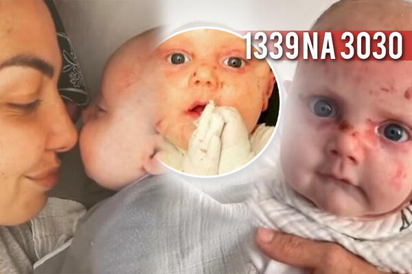 VIKTOR JE DETE LEPTIR, JUNAČKI SE BORI, ALI TRPI JAKE BOLOVE: I najmanji dodir može da ga POVREDI, POMOZIMO! (FOTO)