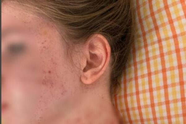 MAJKA PRETUČENE SARE OTKRILA ŠTA JE SVE MONSTRUM RADIO: "Ćerka mi se BORILA ZA ŽIVOT", reč je o SEKUNDAMA