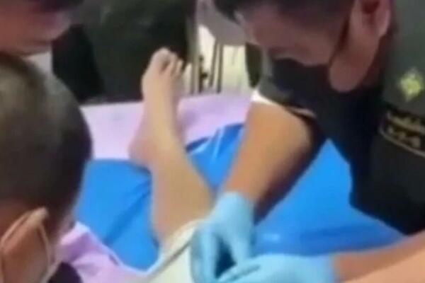 LEKARI MORALI DA SEKU: Muškarac neuspešno pokušavao da poveća "PONOS", a onda je BOL POSTAO NEPODNOŠLJIV! (VIDEO)