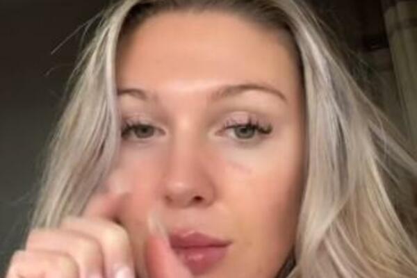 SKINULA JE ŠMINKU I POKAZALA PRAVO LICE: Držaćete se za GLAVU, ŠOK (VIDEO)