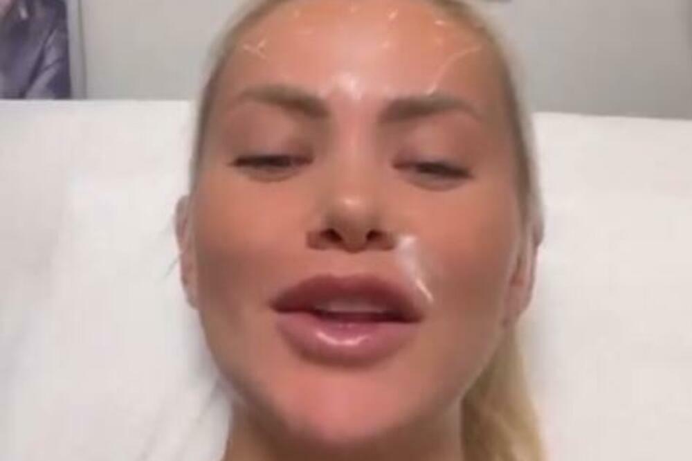 "MRZIM IGLE"! SANJA STANKOVIĆ OTIŠLA NA KOREKCIJU, KORIŠĆEN LOŠ MATERIJAL MORA OPERACIJA